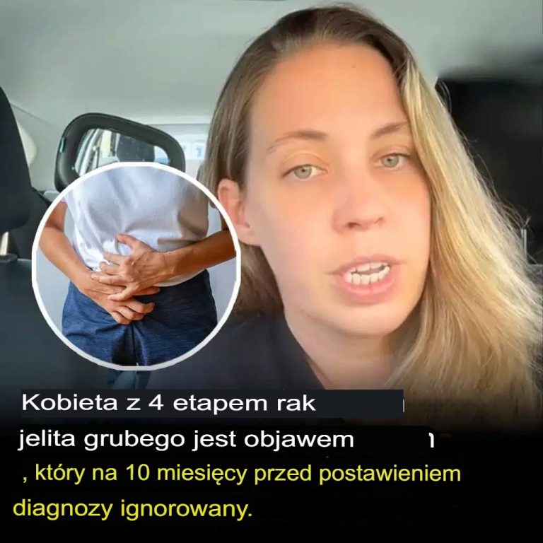 Kobieta z rakiem jelita grubego w stadium 4 dzieli się objawami, które ignorowała 10 miesięcy przed diagnozą