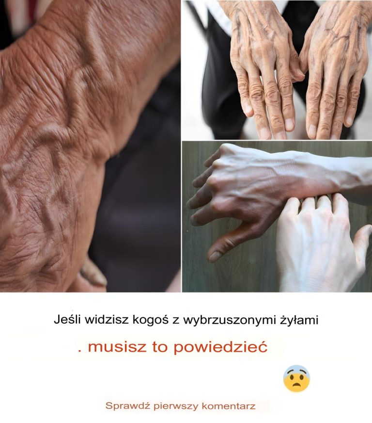 Jeśli widzisz kogoś z wypukłymi żyłami, powiedz mu następujące rzeczy: