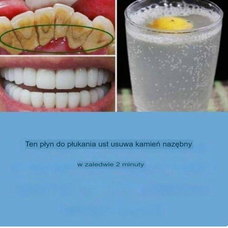 Jak mieć białe zęby: 11 wskazówek, jak mieć piękny uśmiech!