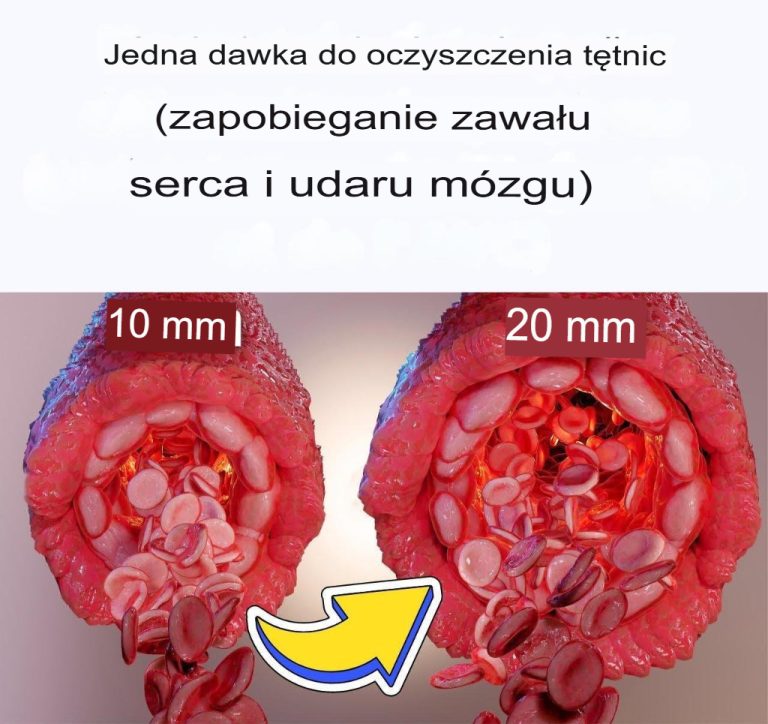 Pojedyncza dawka oczyszczająca tętnice (zapobiegająca zawałowi serca i udarowi mózgu)
