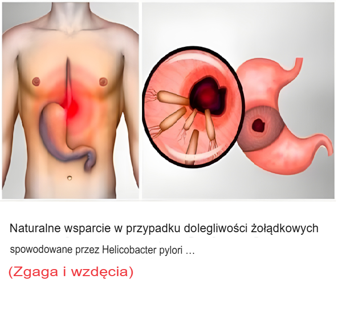 Naturalne wsparcie w przypadku dolegliwości żołądkowych wywołanych przez Helicobacter pylori (zgaga i wzdęcia)
