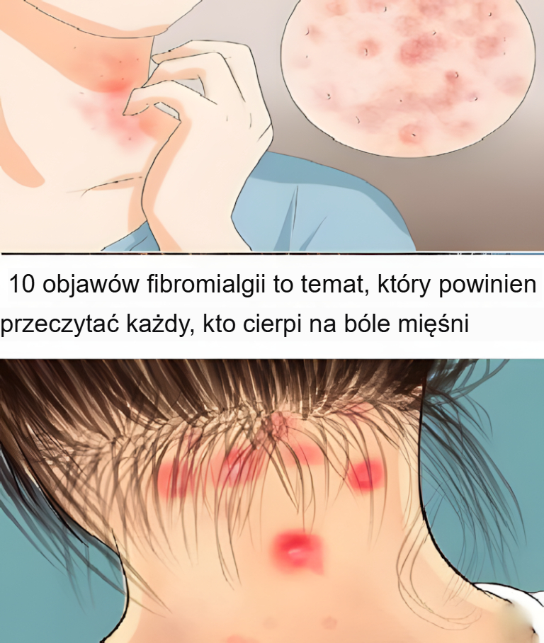 10 objawów fibromialgii, które powinien przeczytać każdy, kto cierpi na bóle mięśni