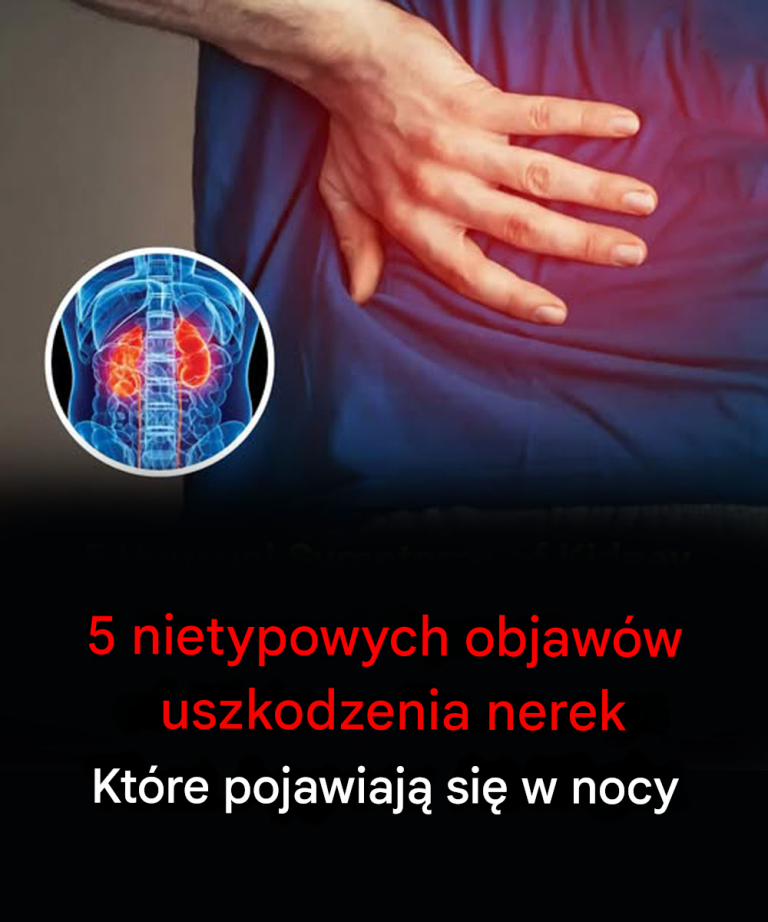 Wskazówki nocne: 5 rzadkich objawów wskazujących na uszkodzenie nerek