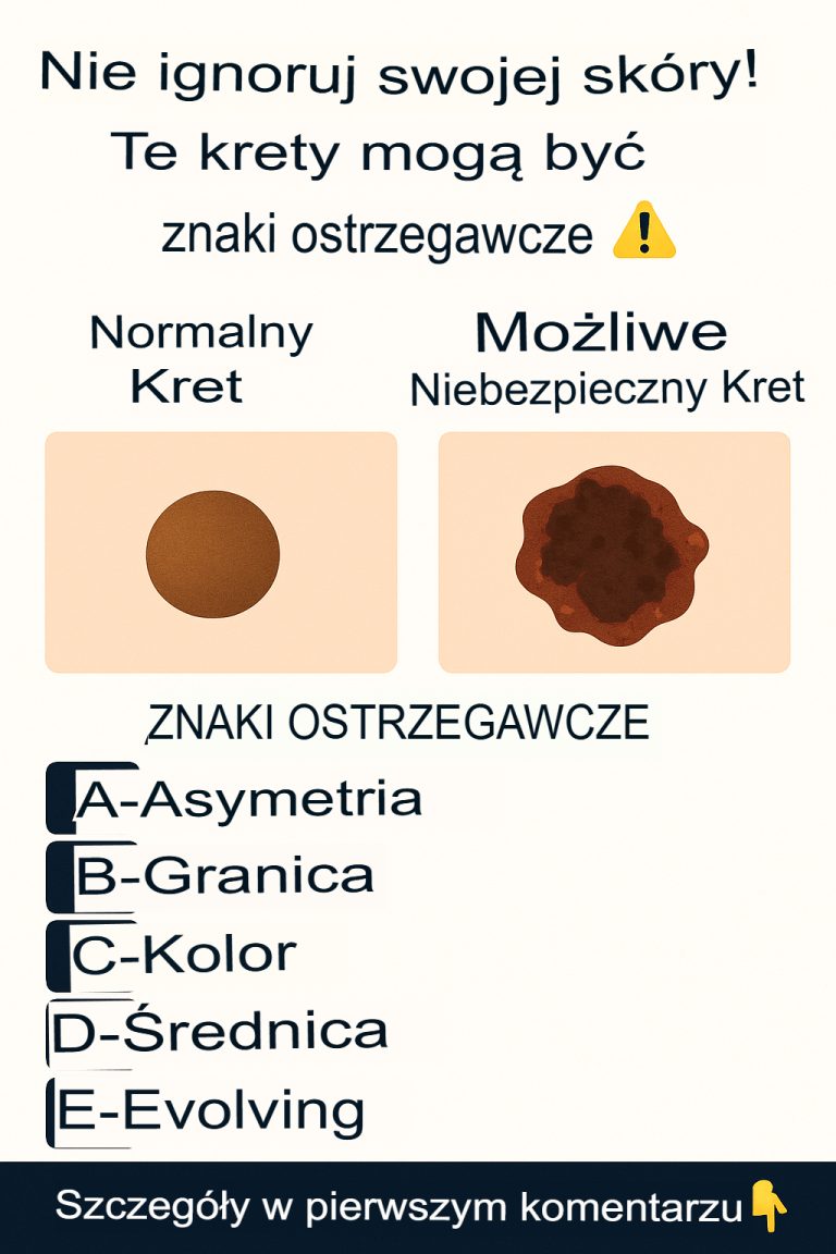 Sprawdź swoją skórę: co mogą Ci powiedzieć znamiona i plamy