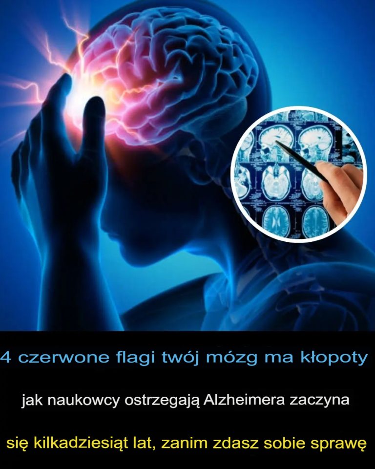 4 czerwone flagi, które mogą wskazywać na problemy z mózgiem – ostrzegają eksperci Choroba Alzheimera może rozpocząć się na dziesiątki lat przed pojawieniem się objawów