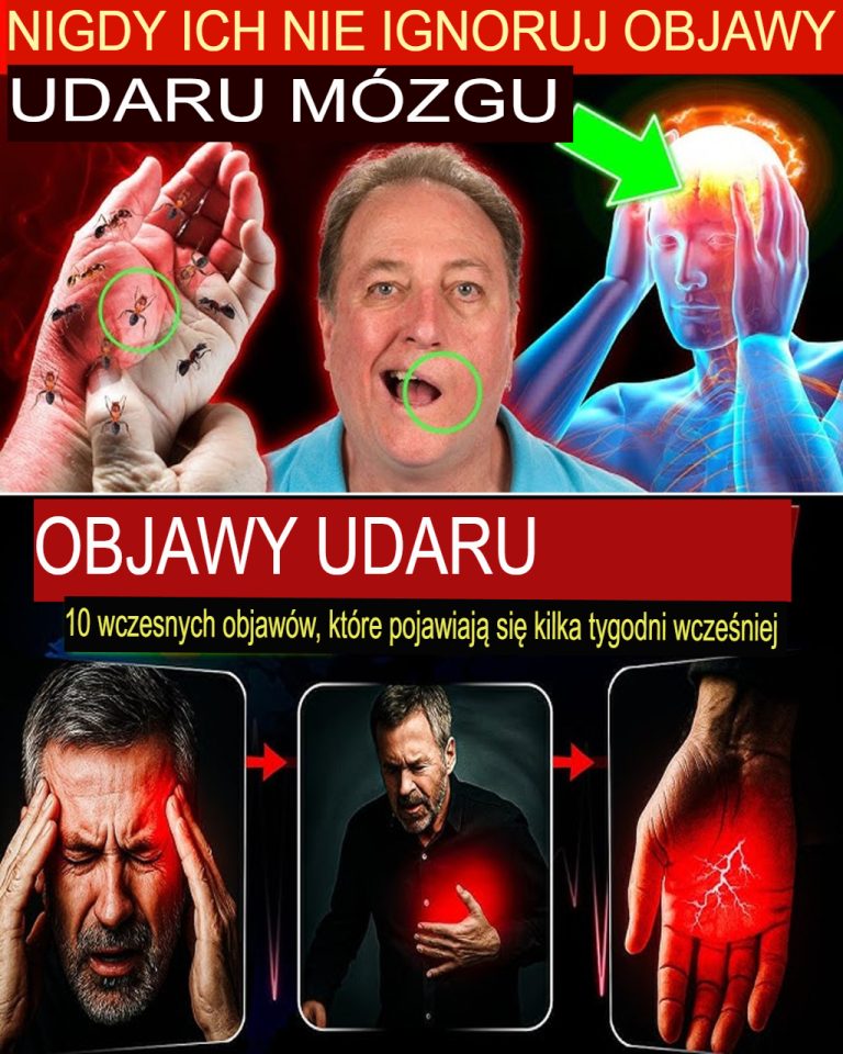 Wykryj te 10 objawów udaru mózgu tydzień wcześniej