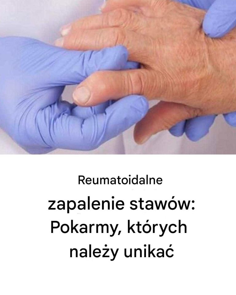 Życie z reumatoidalnym zapaleniem stawów: wyzwania, z którymi mierzysz się każdego dnia