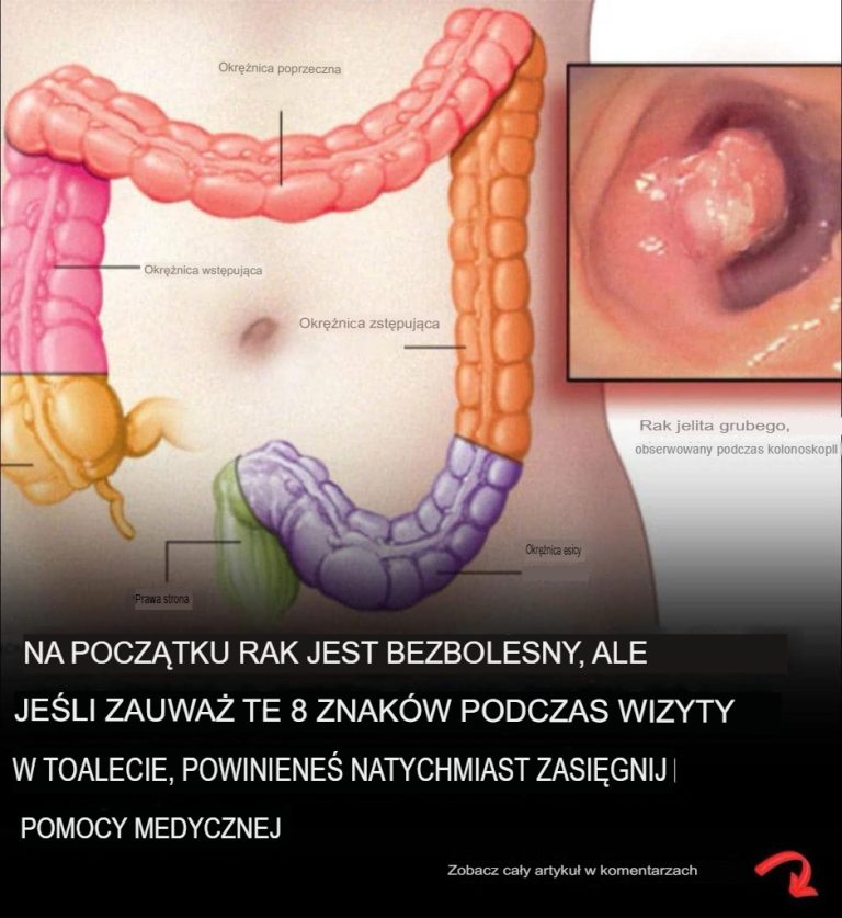 Ponad 40 dziwnych objawów, które mogą wskazywać na diagnozę raka
