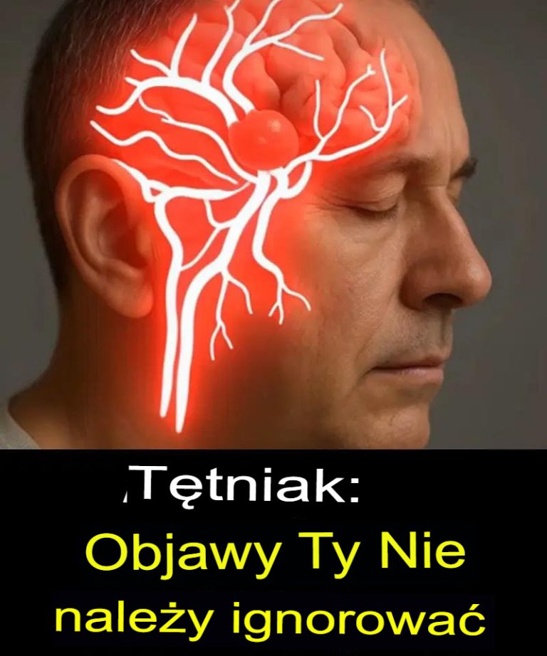 Tętniak: Lekarze błędnie zdiagnozowali pęknięcie tętniaka mózgu w wieku 37 lat – kluczowy sygnał ostrzegawczy, którego nie zauważyli