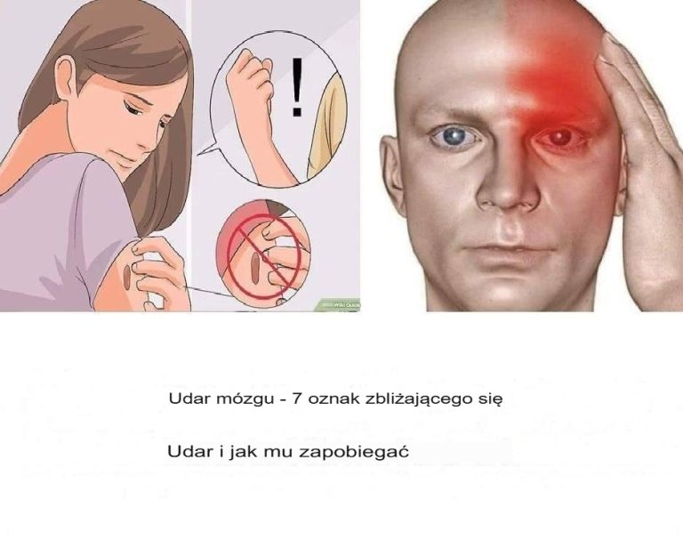 Twój organizm ostrzega Cię miesiąc przed udarem: 10 sygnałów, których nie należy ignorować
