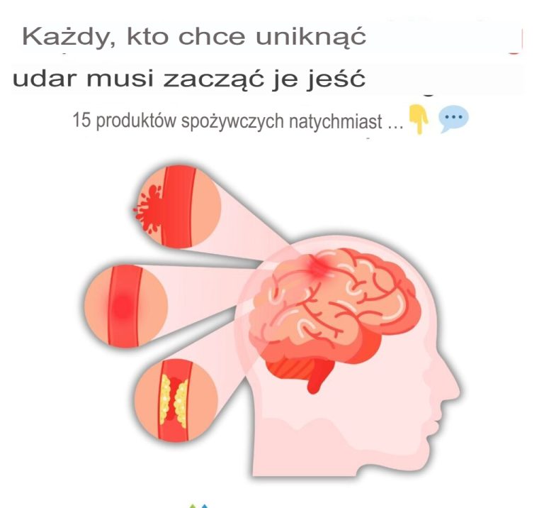 Każdy, kto chce uniknąć udaru, powinien natychmiast zacząć jeść te 15 produktów