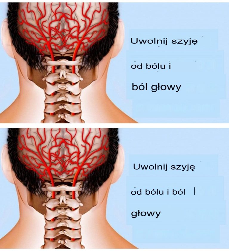 Fizjoterapeuta pokazuje metody łagodzenia bólu szyi i pleców