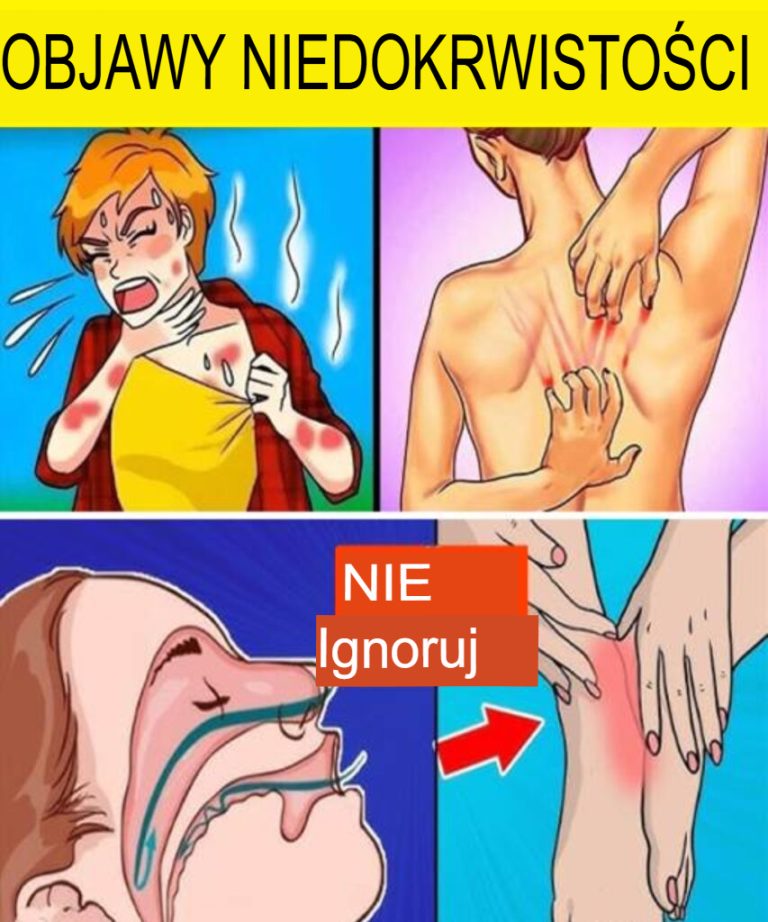 12 cichych objawów anemii, których nie należy ignorować