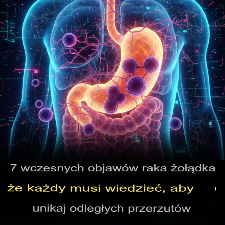 7 wczesnych objawów raka żołądka, które każdy powinien znać, zanim się rozprzestrzeni
