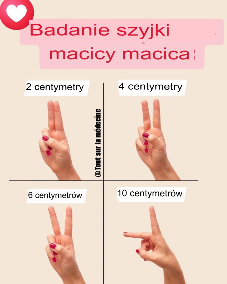 Zrozumienie rozszerzania się szyjki macicy podczas porodu