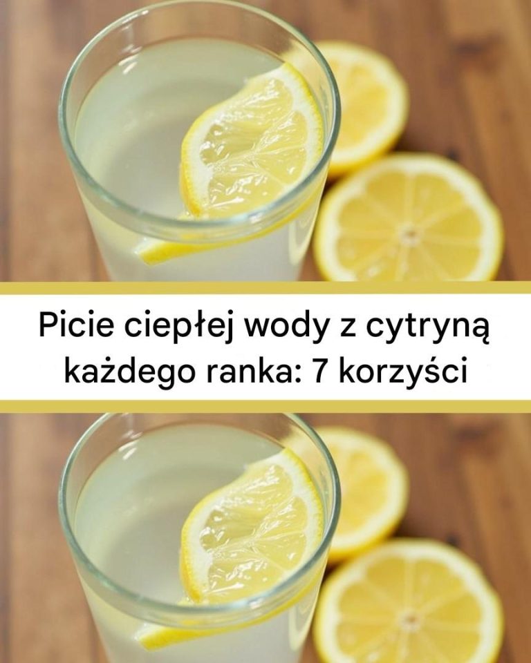 Picie ciepłej wody z cytryną każdego ranka: 7 korzyści, które zmienią Twoją rutynę