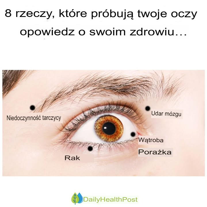 8 rzeczy, które Twoje oczy próbują Ci powiedzieć o Twoim zdrowiu