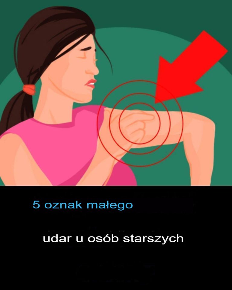 5 objawów mini udaru u seniorów, których nie można ignorować