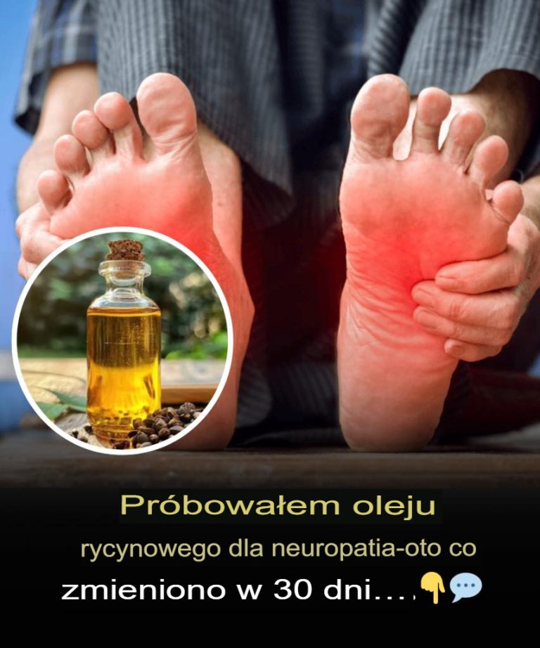 Stosowałam olej rycynowy na neuropatię – oto efekty po 30 dniach!