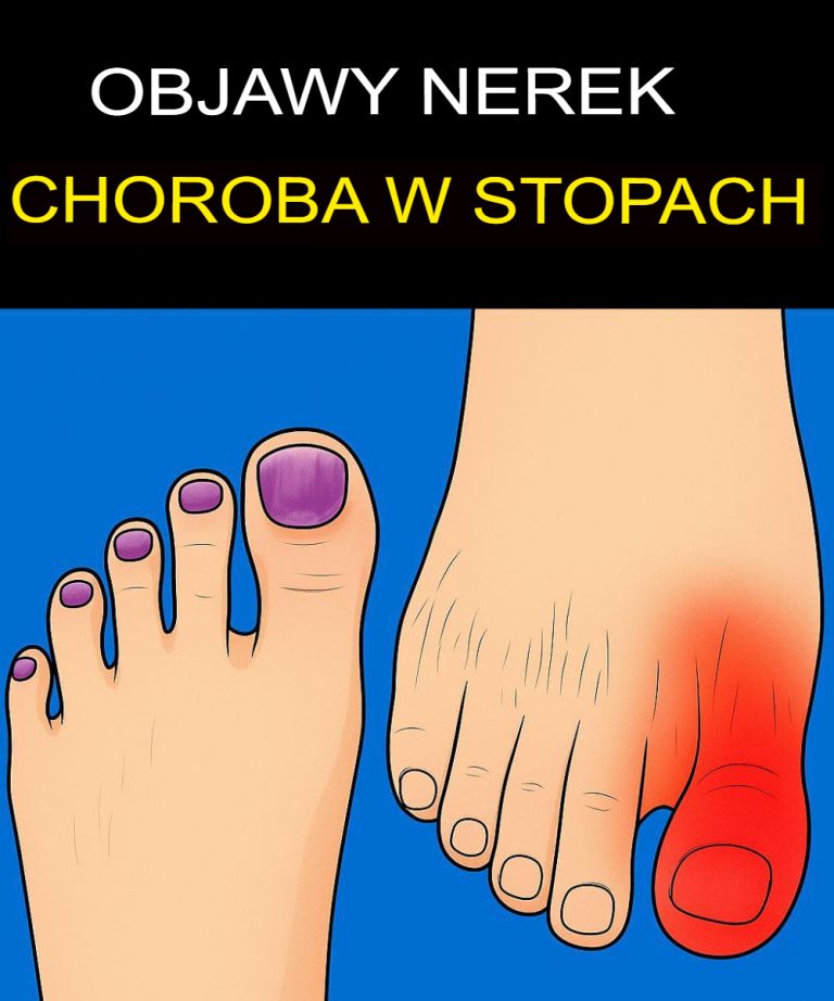 Co Twoje stopy mówią o Twoich nerkach