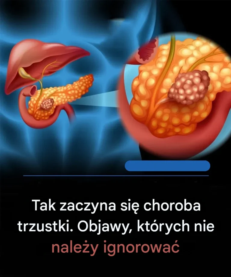 Pancreatic canc3r symptoms you should know, and how the disease develops