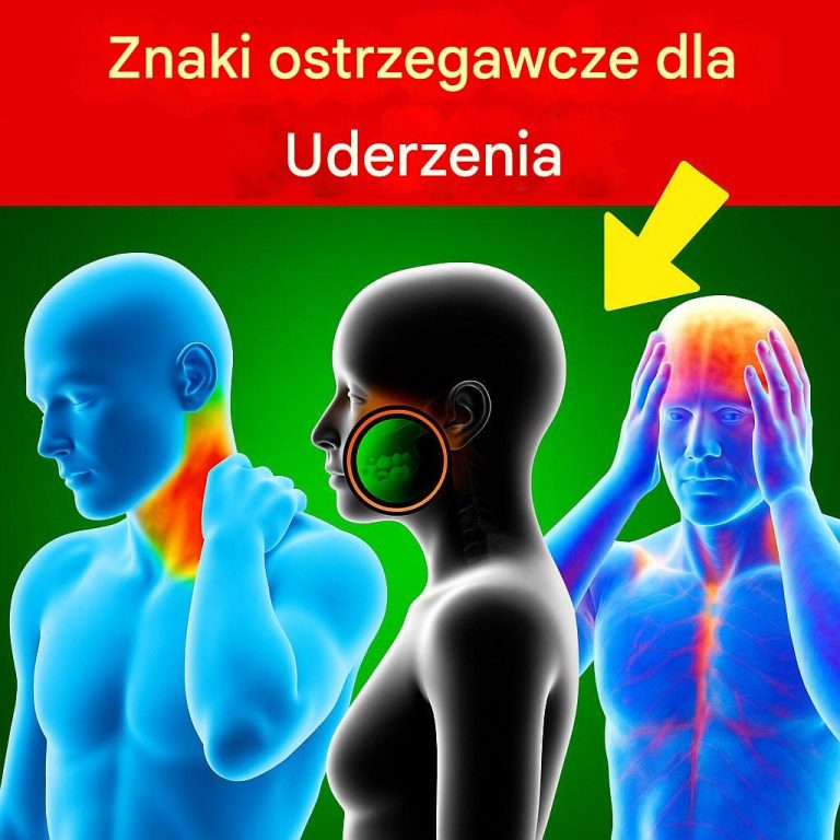 7 objawów udaru mózgu – co musisz wiedzieć!