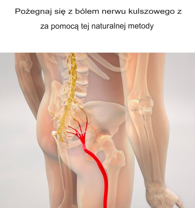 Pożegnaj ból nerwu kulszowego dzięki tej naturalnej metodzie