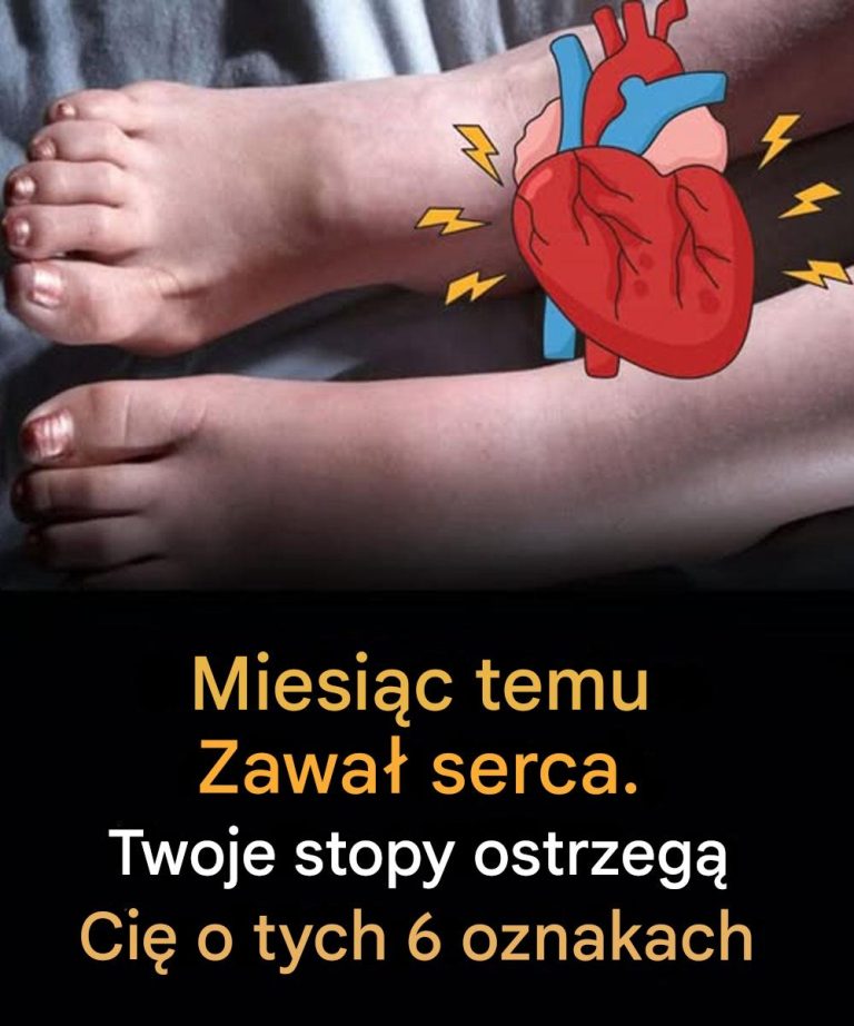 6 cichych oznak w stopach, które mogą ostrzegać przed zawałem serca na kilka tygodni przed zawałem