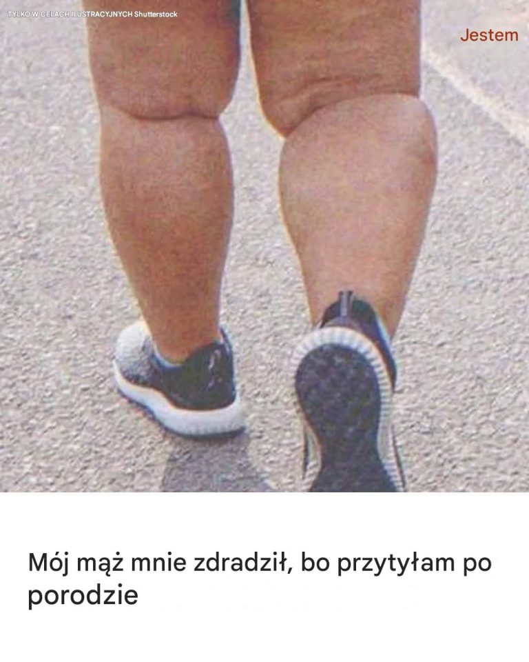 Mój mąż mnie zdradził, bo przytyłam po porodzie: Historia dnia