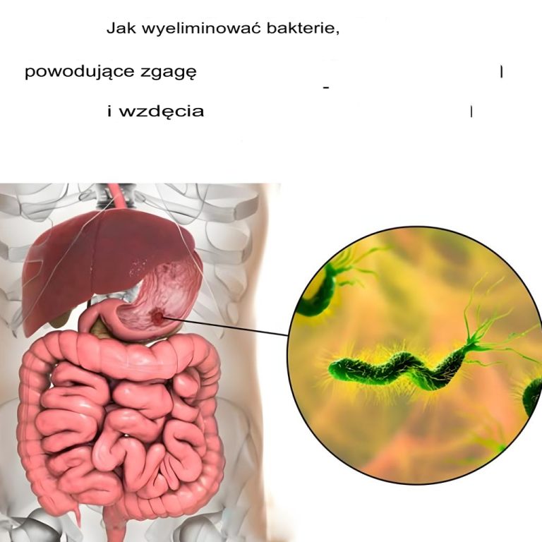Jak wyeliminować bakterie powodujące zgagę i wzdęcia