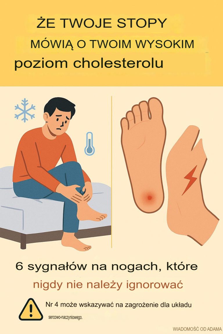 Co Twoje stopy mówią o Twoim wysokim cholesterolu