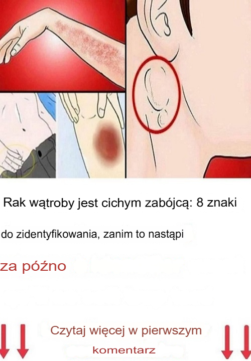 8 ostrzegawczych znaków, że Twoja wątroba jest pełna toksyn i powoduje otyłość