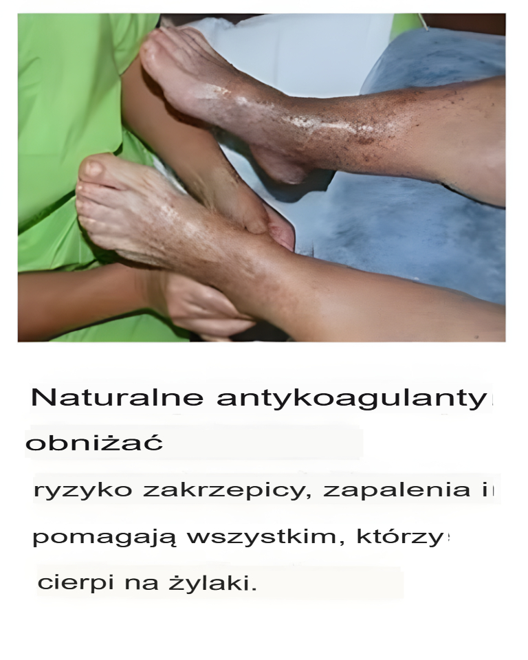 Zakrzepica, cicha choroba, która może być śmiertelna