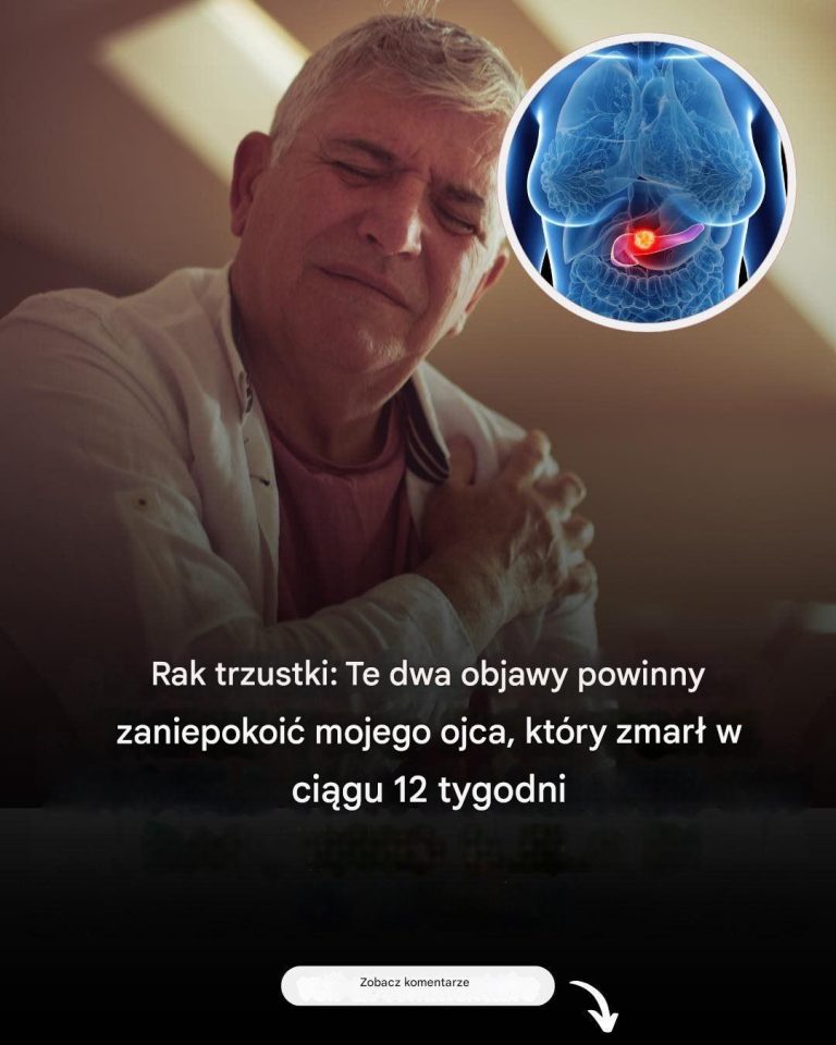 Rak trzustki: dwa wczesne objawy często śmiertelnego nowotworu