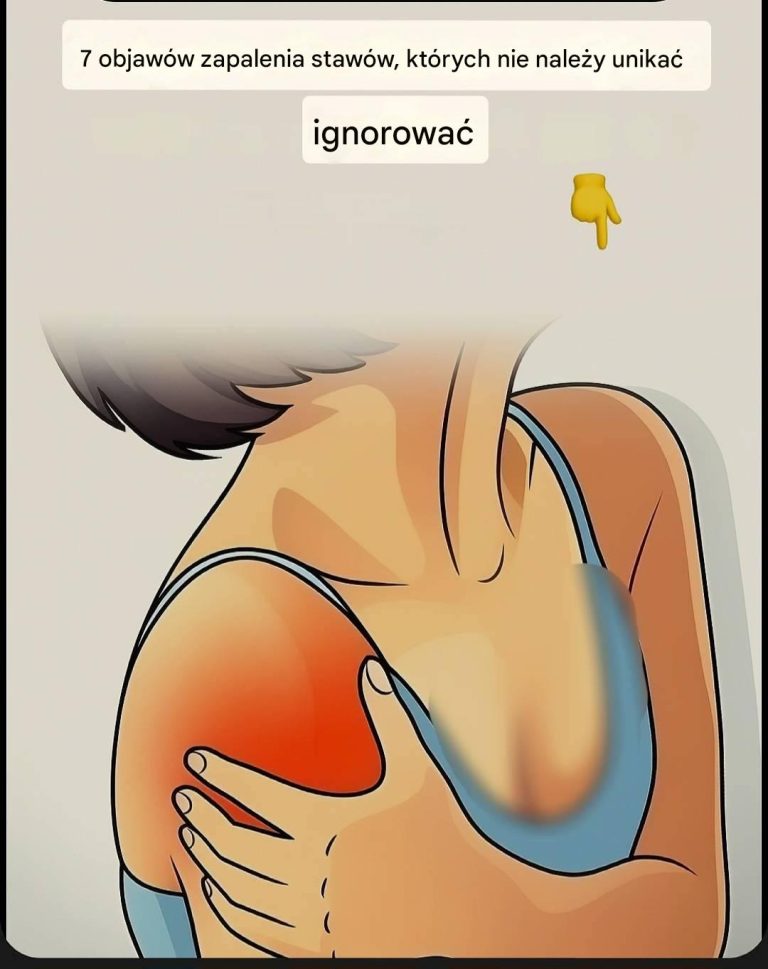 7 objawów fibromialgii