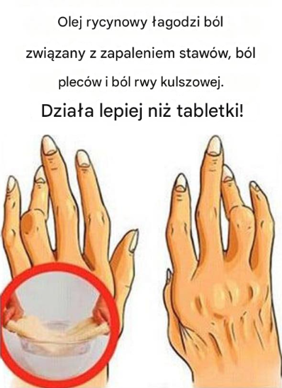 Olej rycynowy na ból pleców, rwę kulszową i artretyzm