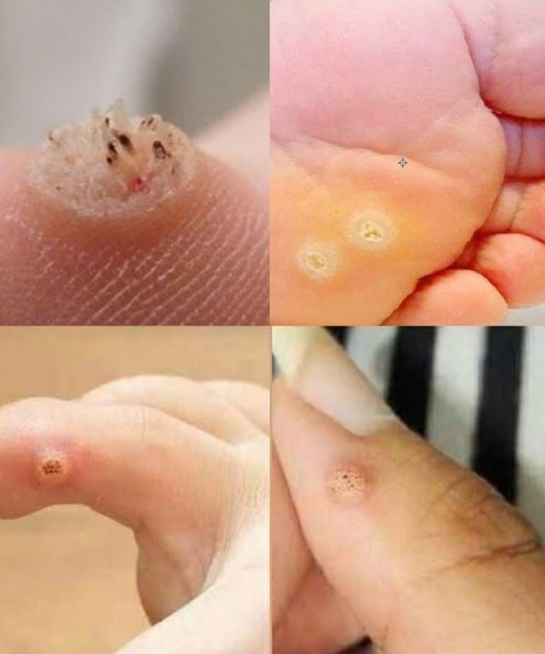 Rozpoznawanie podejrzanych znamion i reagowanie na czas